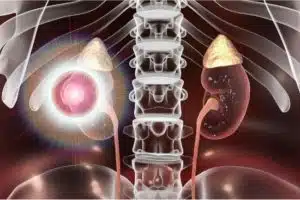 Kidney Disease